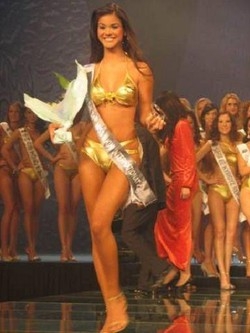 Brasile;Finalista Miss Mondo perde mani e piedi,colpa di un virus