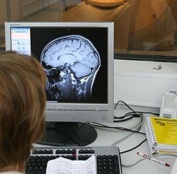 Ricerca/Donne più rapide a riconoscere azioni sbagliate e errori