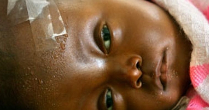 La malaria fa strage ma parlano di ebola