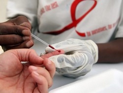 L’Aids è ancora la peste di Varese
E i nuovi malati sono i ventenni